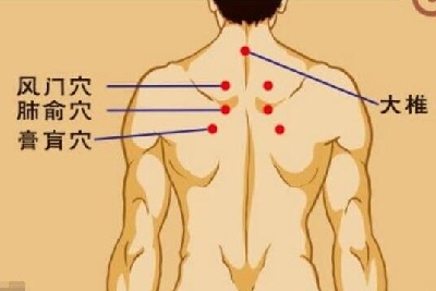 如何正确使用三伏贴？了解正确的位置示意图才能有效缓解疼痛！